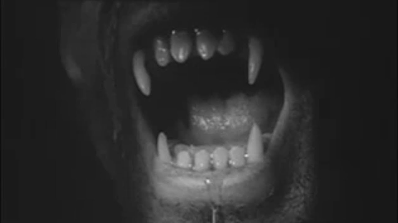 Bei Vollmond Mord - Lycanthropus